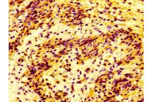 IHC image of ABIN7159070 diluted at 1:100 and staining in paraffin-embedded human lung tissue performed on a Leica BondTM system. (MMP28 抗体  (AA 351-475))