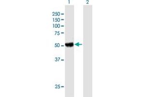 Western Blot analysis of KIAA0368 expression in transfected 293T cell line by KIAA0368 MaxPab polyclonal antibody. (ECM29 抗体  (AA 1-519))