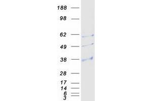 Western Blotting (WB) image for Aquaporin 9 (AQP9) protein (Myc-DYKDDDDK Tag) (ABIN2714854)