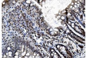 IHC analysis of REA/PHB2 using anti-REA/PHB2 antibody (ABIN7599239). (Prohibitin 2 抗体  (AA 1-299))