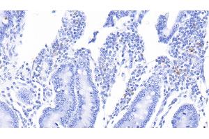 Immunohistochemistry (IHC) image for anti-S100 Calcium Binding Protein A12 (S100A12) (AA 2-92) antibody (ABIN7444682)