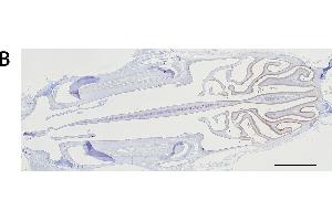 Immunohistochemistry analysis of the expression of the mu and alpha class GSTs. (GSTM4 抗体  (AA 21-215))