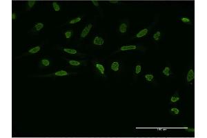 Immunofluorescence of monoclonal antibody to ZIC4 on HeLa cell. (ZIC4 抗体  (AA 1-90))