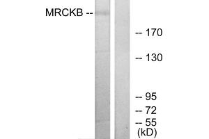 Western blot analysis of extracts from COLO cells, using MRCKB antibody. (CDC42BPB 抗体  (C-Term))
