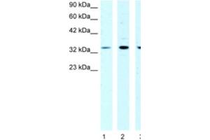 Western Blotting (WB) image for anti-Cold Shock Domain Protein A (CSDA) antibody (ABIN2463852) (CSDA 抗体)