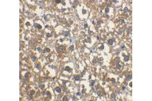 Immunohistochemical staining of rat liver cells using AP30443PU-N IRAK-M antibody at 2 μg/ml. (IRAK3 抗体)