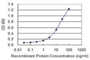 Detection limit for recombinant GST tagged OIP5 is 0. (OIP5 抗体  (AA 1-229))