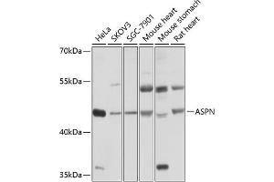Western blot analysis of extracts of various cell lines, using ASPN antibody (ABIN6127375, ABIN6137217, ABIN6137218 and ABIN6214518) at 1:1000 dilution. (Asporin 抗体  (AA 100-379))