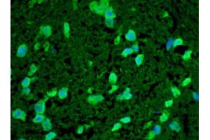 Immunohistochemistry analysis using Rabbit Anti-HSP22 Polyclonal Antibody . (HSPB8 抗体  (FITC))