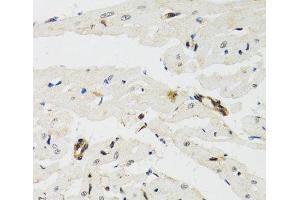 Immunohistochemistry of paraffin-embedded Rat heart using THAP1 Polyclonal Antibody at dilution of 1:100 (40x lens). (THAP1 抗体)