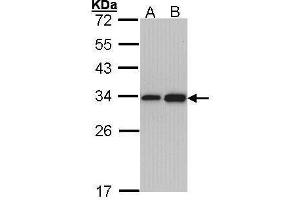 WB Image Sample (30 ug of whole cell lysate) A: Hep G2 , B: Molt-4 , 12% SDS PAGE antibody diluted at 1:1000 (RPL8 抗体)