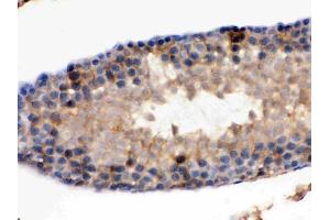 IHC analysis of IDH1 using anti-IDH1 antibody (ABIN3043855).