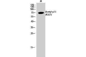 Western Blotting (WB) image for anti-Tumor Protein P73 (TP73) (acLys327) antibody (ABIN3172843) (Tumor Protein p73 抗体  (acLys327))
