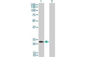 Western Blot analysis of LOC51136 expression in transfected 293T cell line by LOC51136 monoclonal antibody (M01), clone 4H7. (RNFT1 抗体  (AA 1-100))