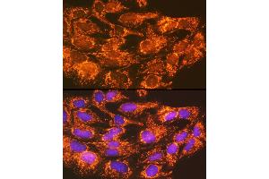 Immunofluorescence (IF) image for anti-Acyl-CoA Synthetase Long-Chain Family Member 1 (Acsl1) (AA 46-275) antibody (ABIN7265423)