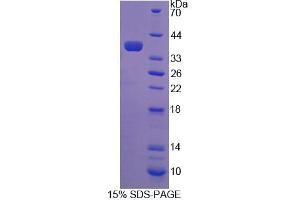 SDS-PAGE analysis of Human COASY Protein. (COASY 蛋白)