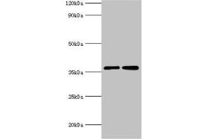 Western blot All lanes: MDH2 antibody at 3 μg/mL Lane 1: 293T whole cell lysate Lane 2: K562 whole cell lysate Secondary Goat polyclonal to rabbit IgG at 1/10000 dilution Predicted band size: 36, 31 kDa Observed band size: 36 kDa (MDH2 抗体  (AA 59-338))