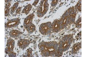 Immunohistochemistry (IHC) image for anti-Electron-Transfer-Flavoprotein, alpha Polypeptide (ETFA) (Center) antibody (ABIN2856049)