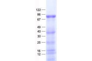 Western Blotting (WB) image for Zinc Finger Protein 175 (ZNF175) protein (His tag) (ABIN2735937)
