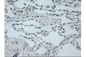 Immunohistochemical staining of paraffin-embedded lung tissue using anti-OSMmouse monoclonal antibody. (Oncostatin M 抗体  (AA 25-252))