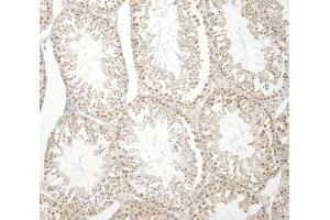 Immunohistochemistry (IHC) image for anti-Heterogeneous Nuclear Ribonucleoprotein U-Like 1 (HNRNPUL1) (AA 50-100) antibody (ABIN7448953)