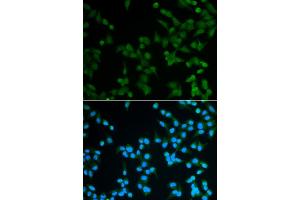Immunofluorescence analysis of A549 cells using SPIN1 antibody (ABIN5973464).
