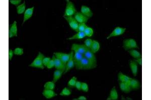 Immunofluorescence staining of Hela cells with ABIN7143823 at 1:133, counter-stained with DAPI. (ACTN3 抗体  (AA 497-667))