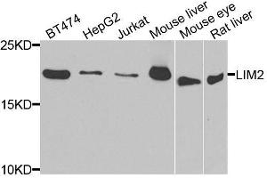 Western blot analysis of extracts of various cell lines, using LIM2 antibody. (LIM2 抗体  (AA 25-110))