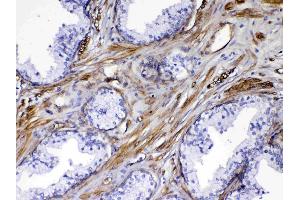 IHC analysis of VEGF Receptor 3 using anti-VEGF Receptor 3 antibody . (FLT4 抗体)