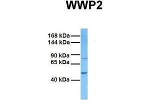 Host:  Rabbit  Target Name:  WWP2  Sample Tissue:  Human Fetal Liver  Antibody Dilution:  1. (WWP2 抗体  (Middle Region))