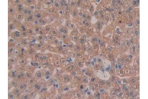 Detection of ITGb3 in Mouse Liver Tissue using Polyclonal Antibody to Integrin Beta 3 (ITGb3)