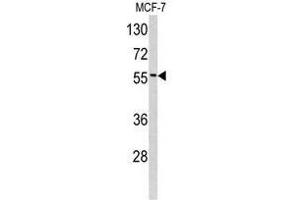 Image no. 1 for anti-Epsin 3 (EPN3) (N-Term) antibody (ABIN452971) (EPN3 抗体  (N-Term))