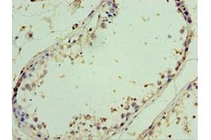 Immunohistochemistry of paraffin-embedded human testis tissue using ABIN7143999 at dilution of 1:100 (AIMP2 抗体  (AA 141-320))