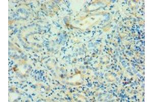 Immunohistochemistry of paraffin-embedded human kidney tissue using ABIN7144130 at dilution of 1:100 (AGT 抗体  (AA 35-285))