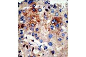 Image no. 3 for anti-Histone Deacetylase 9 (HDAC9) (N-Term) antibody (ABIN356655) (HDAC9 抗体  (N-Term))
