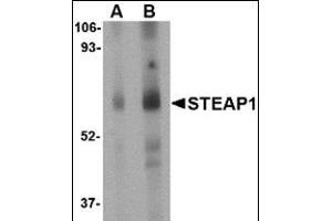 Western blot analysis of STEAP1 in human spleen tissue lysate with this product at (A) 1 and (B) 2 μg/ml. (STEAP1 抗体  (Center))