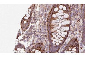 ABIN6272935 at 1/100 staining Mouse colon tissue by IHC-P. (AHCYL1 抗体  (N-Term))