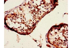 Immunohistochemistry of paraffin-embedded human testis tissue using ABIN7150853 at dilution of 1:100 (Dynein Assembly Factor 4, Axonemal (DNAAF4) (AA 109-295) 抗体)