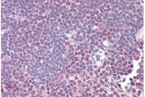Human Thymus (formalin-fixed, paraffin-embedded) stained with ZAP70 antibody ABIN461961 at 20 ug/ml followed by biotinylated anti-mouse IgG secondary antibody ABIN481714, alkaline phosphatase-streptavidin and chromogen. (ZAP70 抗体)
