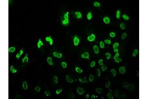 Immunofluorescence staining of Hela cells (treated with 30mM sodium butyrate for 4h) with ABIN7139180 at 1:7. (HIST1H3A 抗体  (acLys37))