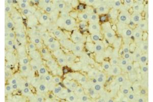 ABIN6276918 at 1/100 staining Mouse liver tissue by IHC-P. (OPTN 抗体)