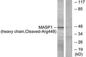 Western blot analysis of extracts from A549 cells, treated with etoposide 25uM 24h, using MASP1 (heavy chain,Cleaved-Arg448) Antibody. (MASP1 抗体  (Cleaved-Arg448))