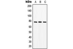 Western blot analysis of PEPT1 expression in Jurkat (A), SP2/0 (B), PC12 (C) whole cell lysates. (SLC15A1 抗体  (Center))