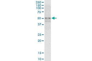 Western Blotting (WB) image for anti-Zinc Finger Protein 296 (ZNF296) (AA 1-475) antibody (ABIN949885)