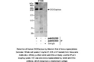 Image no. 1 for anti-Capicua antibody (ABIN363608) (Capicua 抗体)