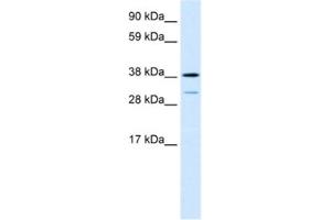 Western Blotting (WB) image for anti-Vacuolar Protein Sorting 72 Homolog (S. Cerevisiae) (VPS72) antibody (ABIN2460856)