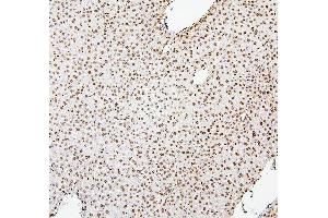 IHC analysis of H1F0 using anti-H1F0 antibody (ABIN7600521).