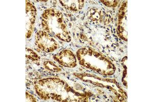 Immunohistochemistry of paraffin-embedded human kidney using SMAD9 antibody at dilution of 1:100 (x400 lens).