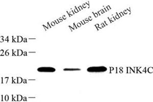 Western blot analysis of P18 INK4C (ABIN7073645) at dilution of 1: 500 (CDKN2C 抗体)
