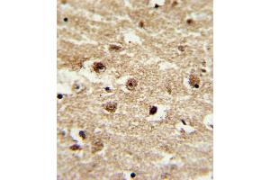 anti-Insulin-Like Growth Factor Binding Protein 2, 36kDa (IGFBP2) (AA 277-305), (C-Term) antibody